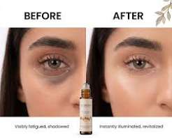 Glowrify Under Eye Serum – Dark Circle & Puffiness Care 10ML